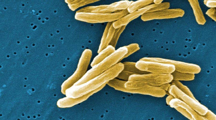 Is tuberculosis making a comeback?