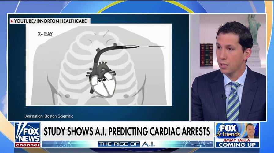 Study shows AI can predict heart attacks 