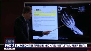 Michael Keetley's surgeon testifies in murder trial - Fox News
