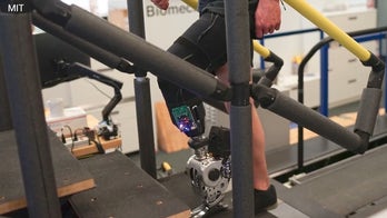 Breakthrough prosthetic technology enables natural movement through nervous system connection