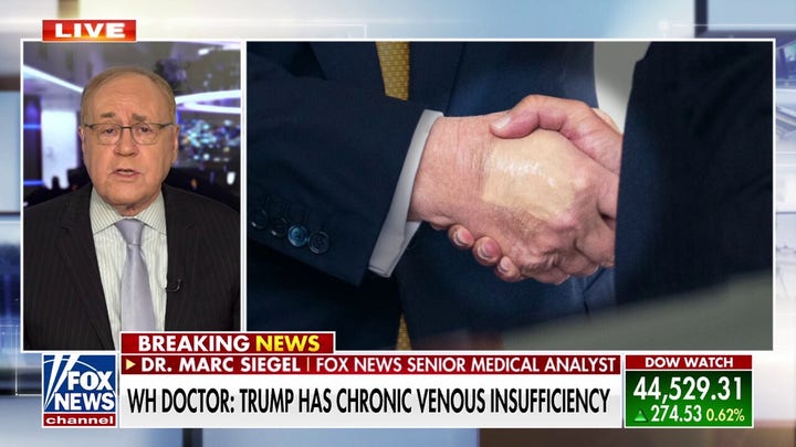 What President Donald Trump's chronic venous insuffiency means