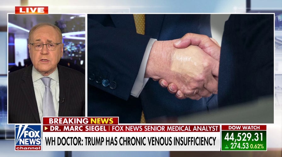 What President Donald Trump's chronic venous insuffiency means
