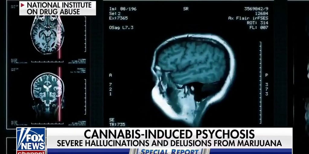 Study links high THC levels to mental health issues Fox News Video