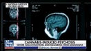 Study links high THC levels to mental health issues