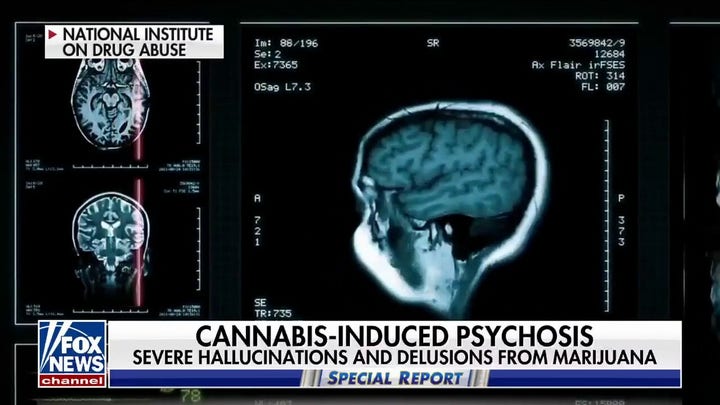 Study links high THC levels to mental health issues