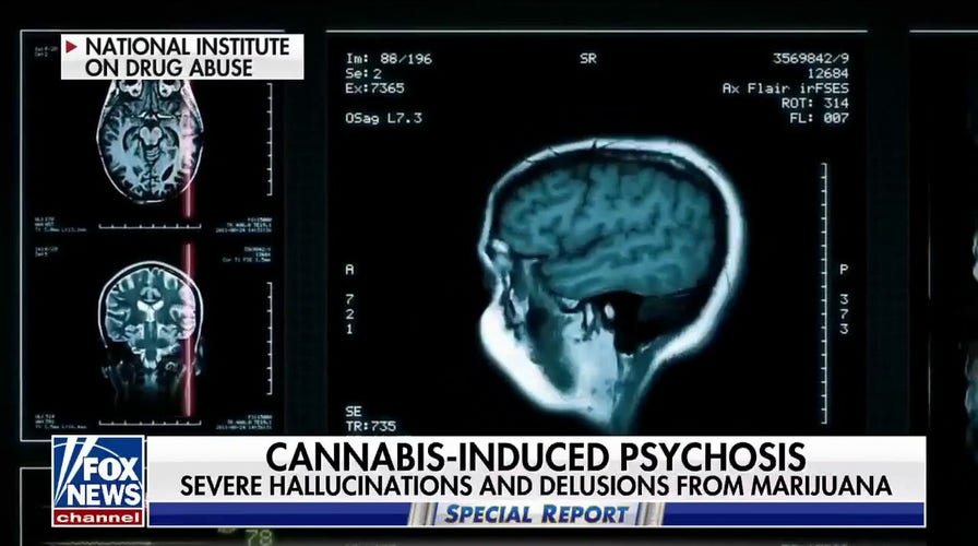Study links high THC levels to mental health issues