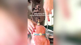 Woman slices bunion off foot-shaped birthday post-surgery - Fox News
