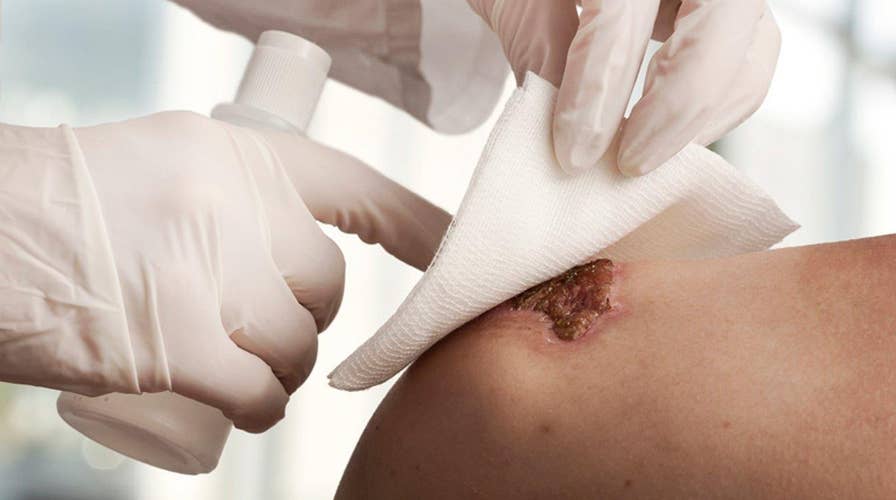 Human membrane could revolutionize wound treatment