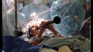 Woman with Parkinson’s plays clarinet during operation in remarkable scene