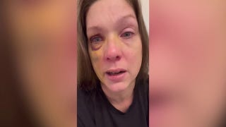 Cincinnati beating victim speaks out