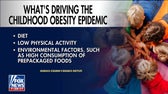 Murdoch Institute promotes diet, sleep strategies to combat childhood obesity