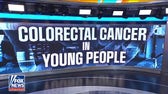 New study links increased bacteria exposure to early-onset colon cancer