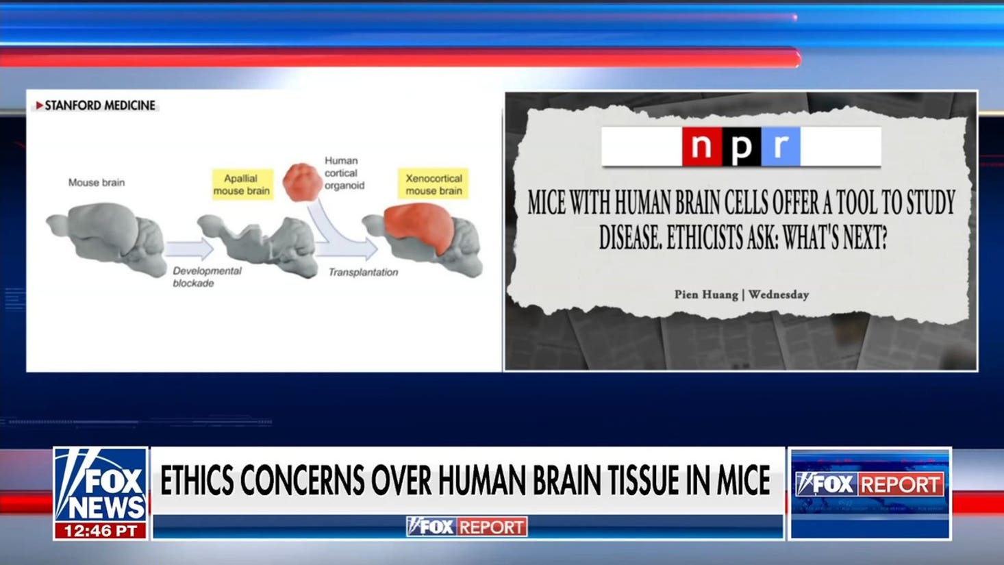 Stanford researchers face ethics concerns over transplanting human brain tissue to mice