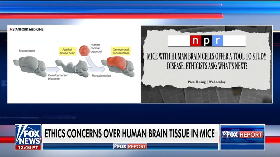 Stanford researchers face ethics concerns over transplanting human brain tissue to mice
