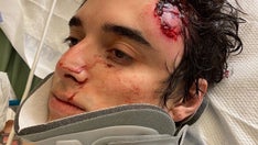 Marine Corps veteran shot with rubber bullets by police at protest, ‘I had my hands up’