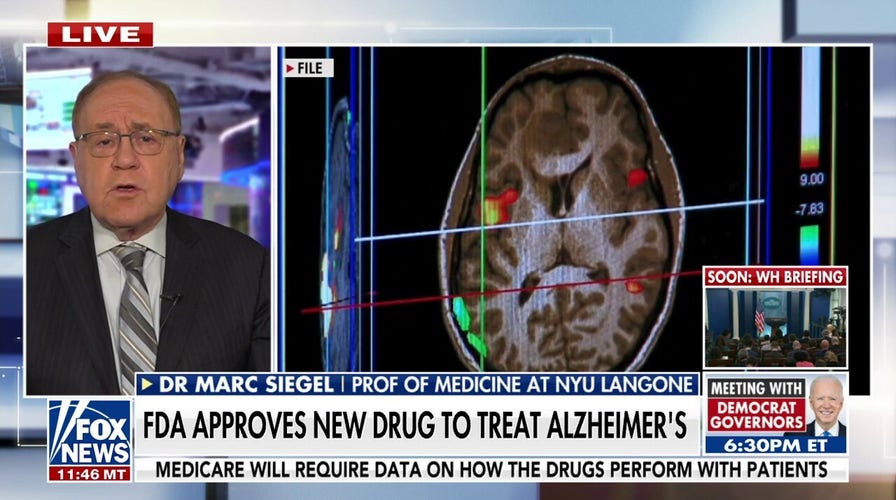 FDA approves new Alzheimer’s treatment option