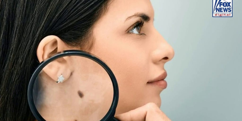 Cancer vaccine cuts melanoma risk nearly 50% in breakthrough study