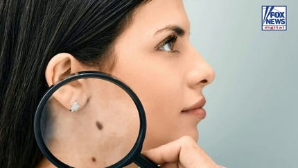 Cancer vaccine cuts melanoma risk nearly 50% in breakthrough study