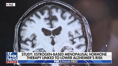 Estrogen linked to lower Alzheimer's risk