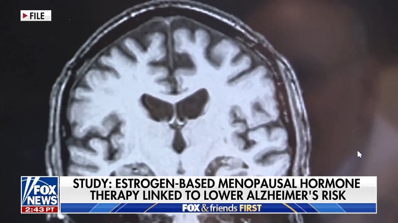 Estrogen linked to lower Alzheimer's risk