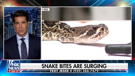 Snake bites surging across America