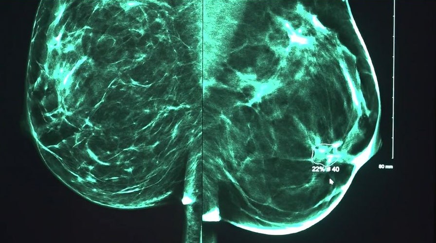 How artificial intelligence is being used to detect breast cancer