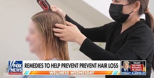 Physician shares remedies to help prevent hair loss