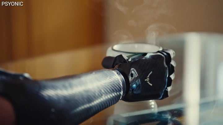 'CyberGuy': The world's first touch-sensing bionic hand with lightning-fast response