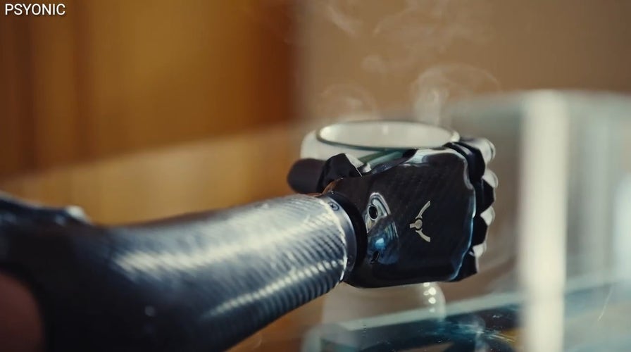 'CyberGuy': The world's first touch-sensing bionic hand with lightning-fast response