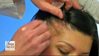 High-Tech techniques for battling GLP-1 hair loss