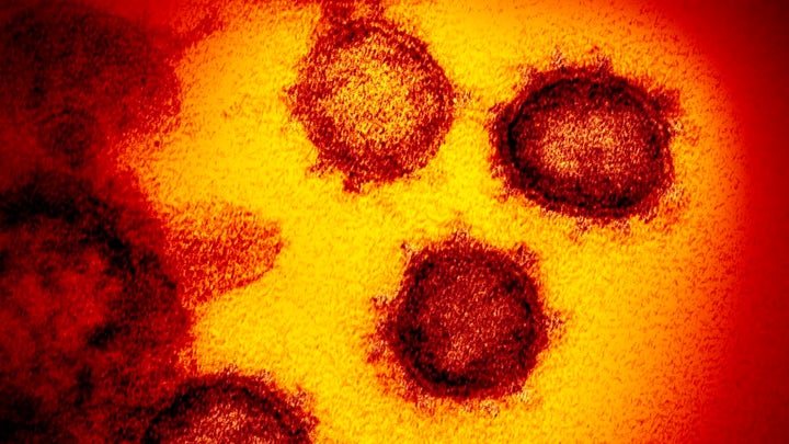 Officials say it's likely US will have a coronavirus outbreak