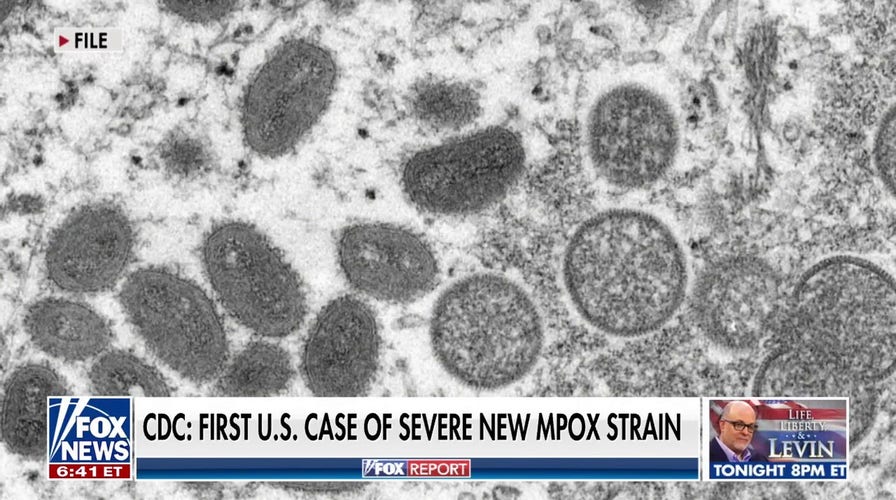 Doctor shares what people should know about a new mpox strain