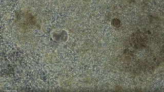 Beating heart cells derived from stem cells shown up close - Fox News