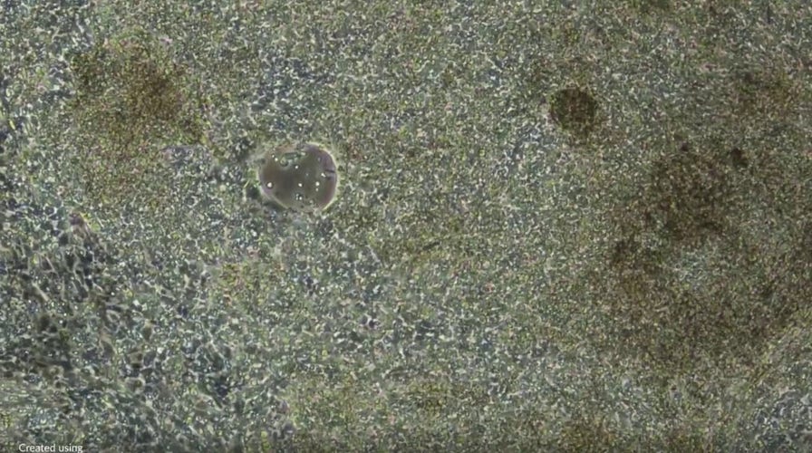 Beating heart cells derived from stem cells shown up close