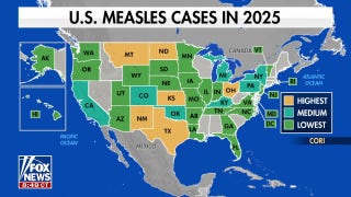 CDC warns measles cases surging nationwide