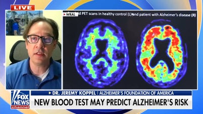 New blood test may predict Alzheimer's disease risk