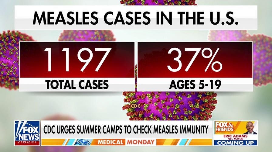 CDC urges summer camps to check for measles immunity 