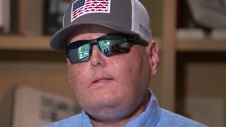 Firefighter talks new life 5 years after historic face transplant