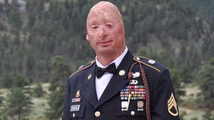 EXCLUSIVE: Wounded Army vet slams Democrats for using him as a ‘prop’ to turn veterans against Trump