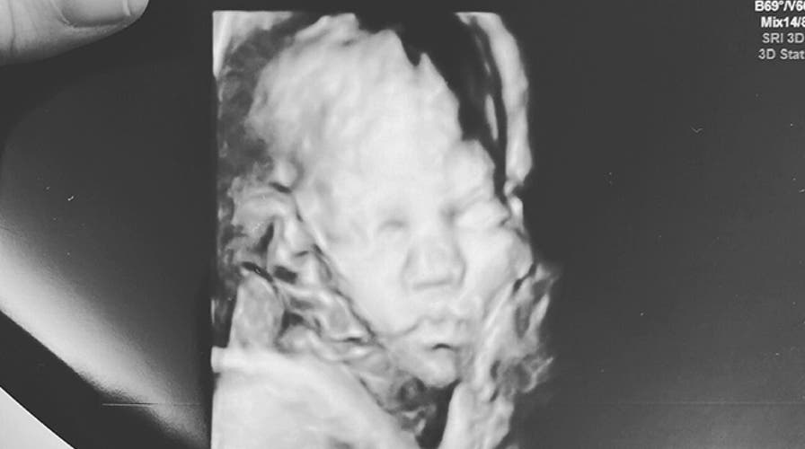 Mom-to-be shares her fears about coronavirus