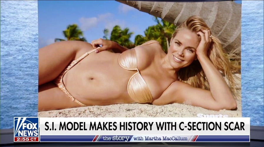 Sports Illustrated model photographed with C-section scar makes history