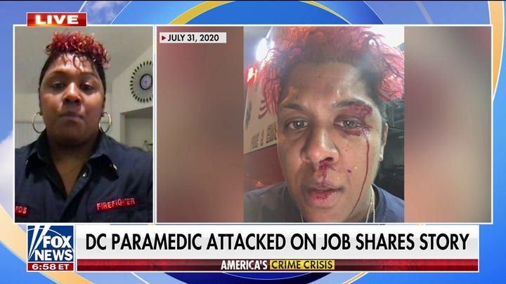 DC paramedic left traumatized after an unprovoked attack left her bloody, battered on the job