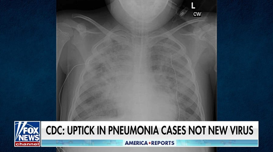 States report spike in child pneumonia cases
