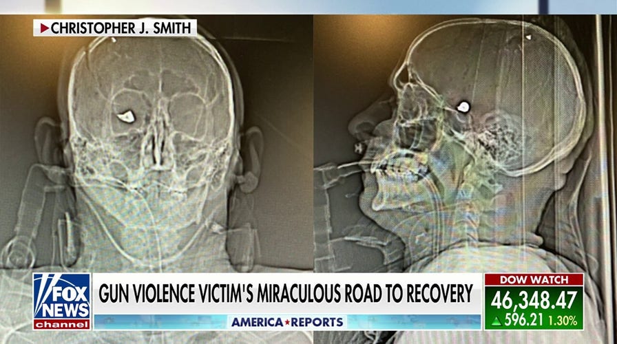  Inside a weapon  unit   victim's miraculous survival