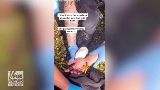 Woman tried to help hawk on side of the road in Florida — then it attacked her - Fox News