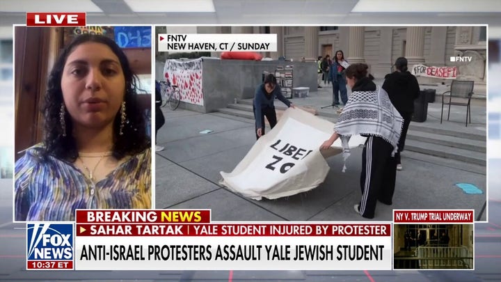 Yale student stabbed in the eye during anti-Israel protest