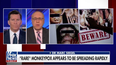 Dr. Marc Siegel: What is monkeypox and how does it spread?