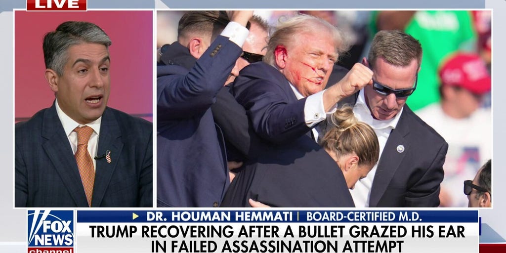 Trump 'narrowly avoided' facial nerve damage during assassination attempt, doctor warns