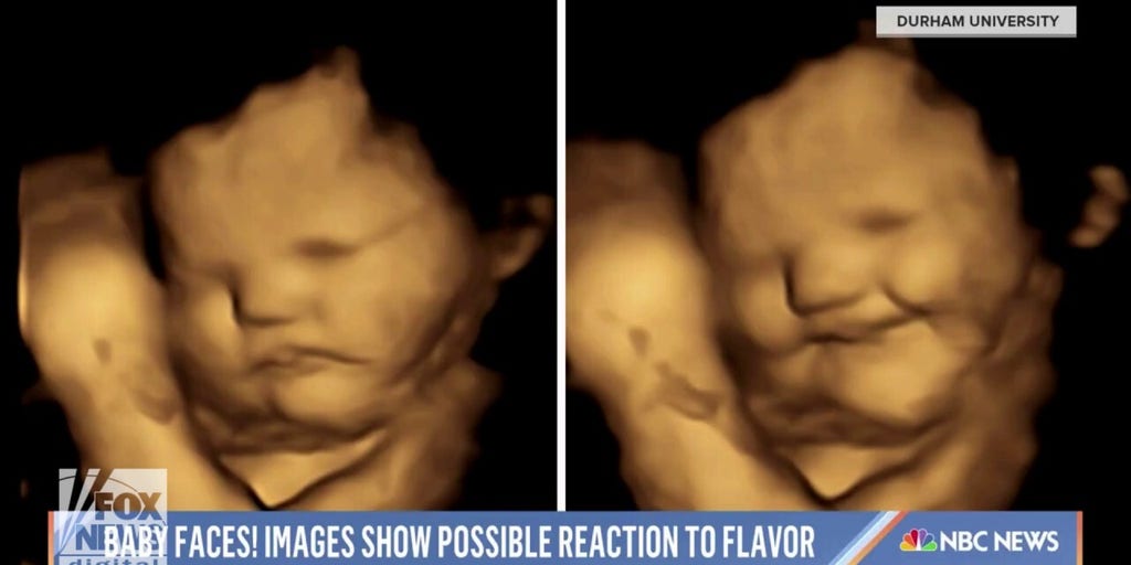 Prolifers highlight NBC segment showing 'babies in the womb' can react