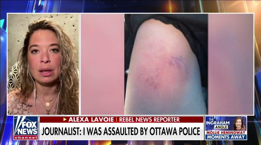 Journalist: I was assaulted by Ottowa police